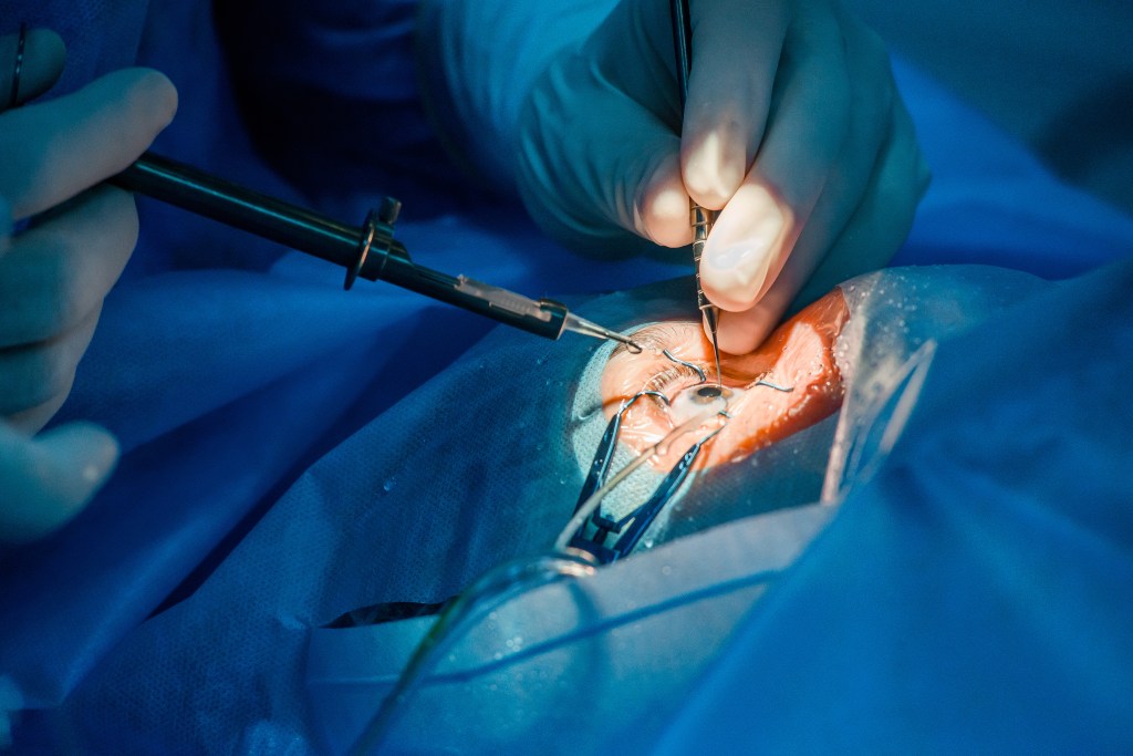 eye procedure. needs education and marketing